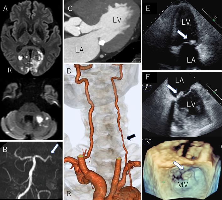 https://cdn.ncbi.nlm.nih.gov/pmc/blobs/818d/8355388/e2d4b04976c5/1349-7235-60-2315-g001.jpg