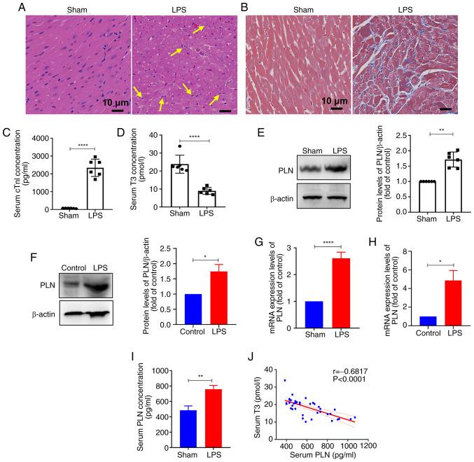 https://cdn.ncbi.nlm.nih.gov/pmc/blobs/81a1/11781518/43c40e083c3b/ijmm-55-03-05488-g00.jpg