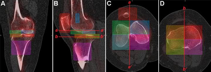 https://cdn.ncbi.nlm.nih.gov/pmc/blobs/81a1/9561658/d655c7e373bb/10.1177_23259671221121083-fig2.jpg