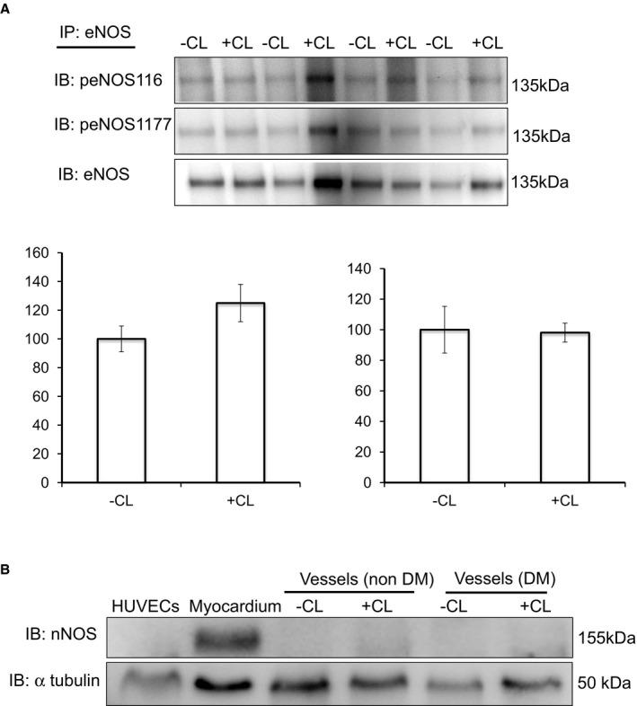 https://cdn.ncbi.nlm.nih.gov/pmc/blobs/81a5/4802476/63192a57a314/JAH3-5-e002824-g007.jpg