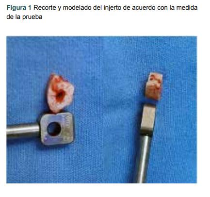 https://cdn.ncbi.nlm.nih.gov/pmc/blobs/81aa/10773913/8ede3e3510d0/04435117-61-Suppl2-S193-f001.jpg