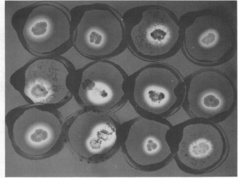 https://cdn.ncbi.nlm.nih.gov/pmc/blobs/81ad/186865/ff788cc50180/applmicro00018-0093-a.jpg