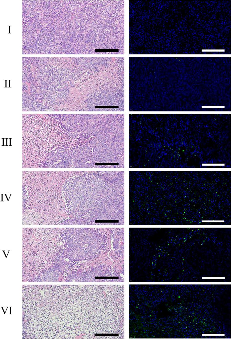 https://cdn.ncbi.nlm.nih.gov/pmc/blobs/81af/8881933/777d2c27000a/IJN-17-837-g0007.jpg