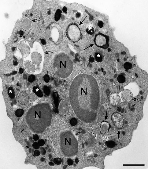 https://cdn.ncbi.nlm.nih.gov/pmc/blobs/81b1/2491708/8e786bd51839/418_2008_461_Fig4_HTML.jpg
