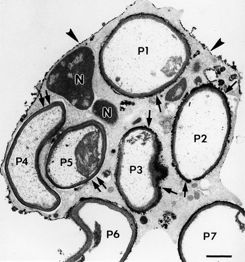 https://cdn.ncbi.nlm.nih.gov/pmc/blobs/81b1/2491708/a7dccff212cc/418_2008_461_Fig5_HTML.jpg