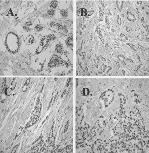 https://cdn.ncbi.nlm.nih.gov/pmc/blobs/81b3/2376286/6e192f285fbc/87-6600654f2.jpg
