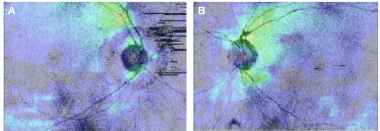 https://cdn.ncbi.nlm.nih.gov/pmc/blobs/81b9/11002814/cf80b93c929a/cureus-0016-00000055878-i03.jpg