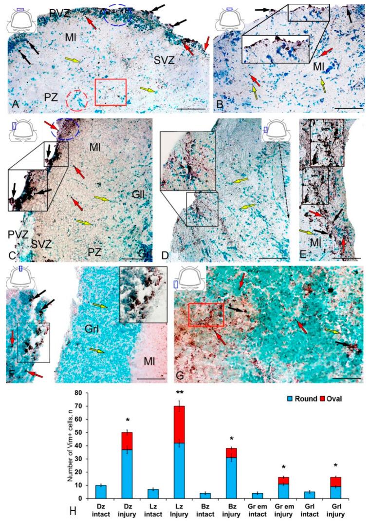https://cdn.ncbi.nlm.nih.gov/pmc/blobs/81bf/7766854/51f26b4e5a8c/ijms-21-09638-g004.jpg