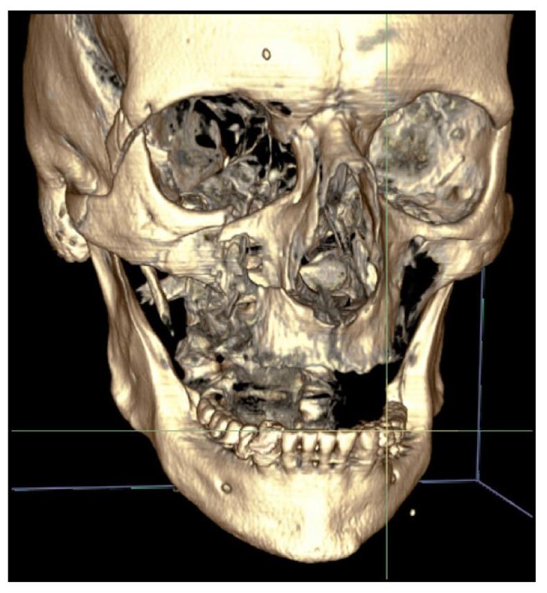 https://cdn.ncbi.nlm.nih.gov/pmc/blobs/81c6/6129990/3ecbf5b2e24c/TODENTJ-12-377_F1.jpg