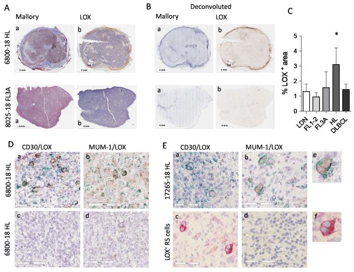 https://cdn.ncbi.nlm.nih.gov/pmc/blobs/81c8/8750937/50be4aeff66d/cancers-14-00259-g004.jpg