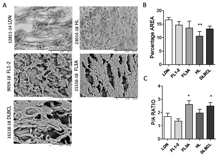 https://cdn.ncbi.nlm.nih.gov/pmc/blobs/81c8/8750937/cfebe3ee8f27/cancers-14-00259-g002.jpg