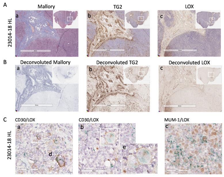 https://cdn.ncbi.nlm.nih.gov/pmc/blobs/81c8/8750937/e750249f4653/cancers-14-00259-g005.jpg
