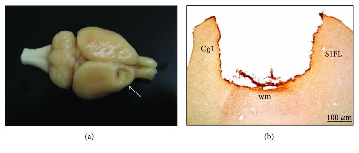 https://cdn.ncbi.nlm.nih.gov/pmc/blobs/81cc/5883990/7fc1bce43d08/NP2018-6125901.003.jpg