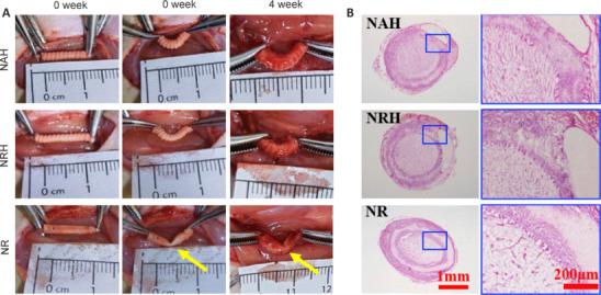 https://cdn.ncbi.nlm.nih.gov/pmc/blobs/81d7/11691465/728a759f879f/NRR-20-2084-g005.jpg