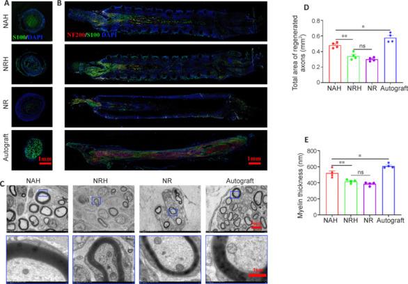 https://cdn.ncbi.nlm.nih.gov/pmc/blobs/81d7/11691465/b60d9bab4de4/NRR-20-2084-g006.jpg
