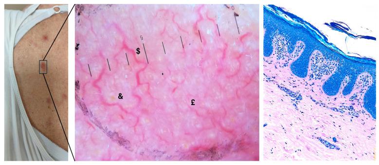 https://cdn.ncbi.nlm.nih.gov/pmc/blobs/81e8/12072082/756583b0e610/diagnostics-15-01136-g001.jpg