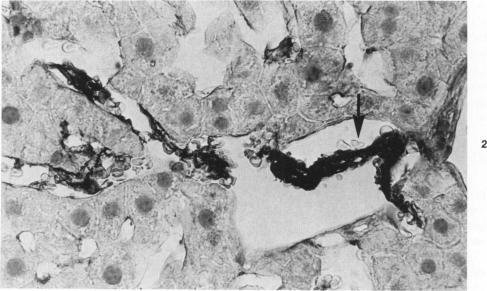 https://cdn.ncbi.nlm.nih.gov/pmc/blobs/81f7/1903852/255b6ac7673b/amjpathol00219-0007-b.jpg