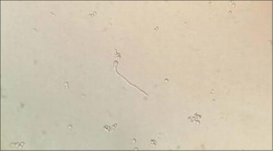 https://cdn.ncbi.nlm.nih.gov/pmc/blobs/81fd/10112072/38dc18438c07/JOMFP-26-590-g003.jpg