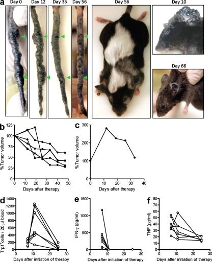 https://cdn.ncbi.nlm.nih.gov/pmc/blobs/8206/2839156/9702379a6a95/JEM_20091918_RGB_Fig7.jpg