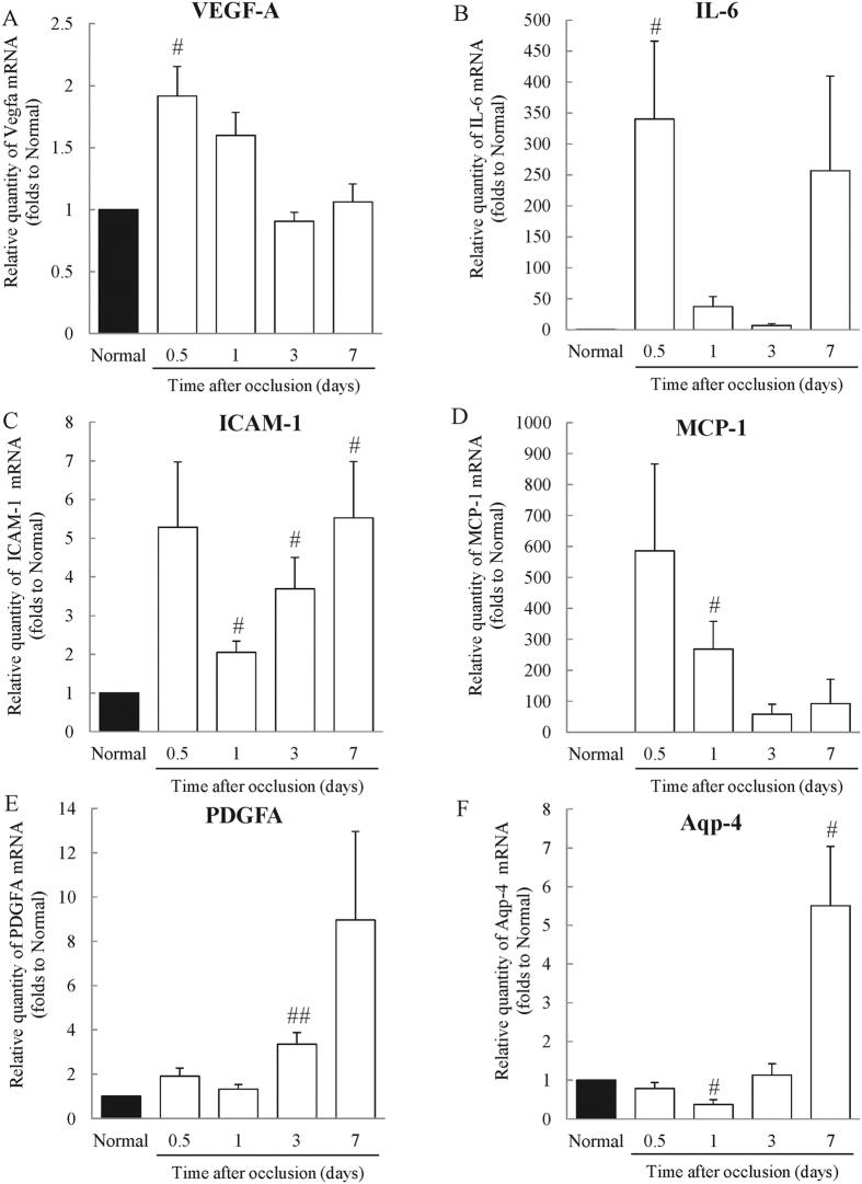 https://cdn.ncbi.nlm.nih.gov/pmc/blobs/820e/5333144/a52e7853426f/srep43509-f6.jpg