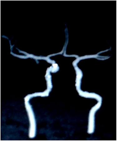 https://cdn.ncbi.nlm.nih.gov/pmc/blobs/820e/7769192/2ec17421102b/rjaa500f1.jpg