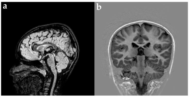 https://cdn.ncbi.nlm.nih.gov/pmc/blobs/8215/11431710/17ca80ed7f27/genes-15-01219-g003.jpg