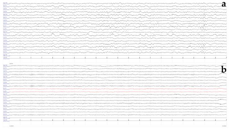 https://cdn.ncbi.nlm.nih.gov/pmc/blobs/8215/11431710/f0e5ca288f42/genes-15-01219-g002.jpg