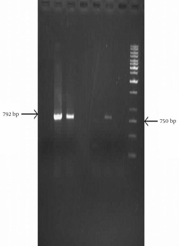 https://cdn.ncbi.nlm.nih.gov/pmc/blobs/8217/4295313/edee573face5/jjm-07-11924-g003.jpg