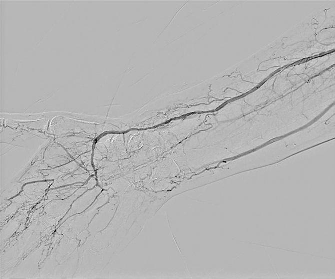 https://cdn.ncbi.nlm.nih.gov/pmc/blobs/821f/12078088/1367379514f6/2432-0935-10-e2024-0033-g005.jpg