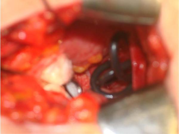 https://cdn.ncbi.nlm.nih.gov/pmc/blobs/8221/2649937/a09087234c09/1752-1947-3-49-3.jpg