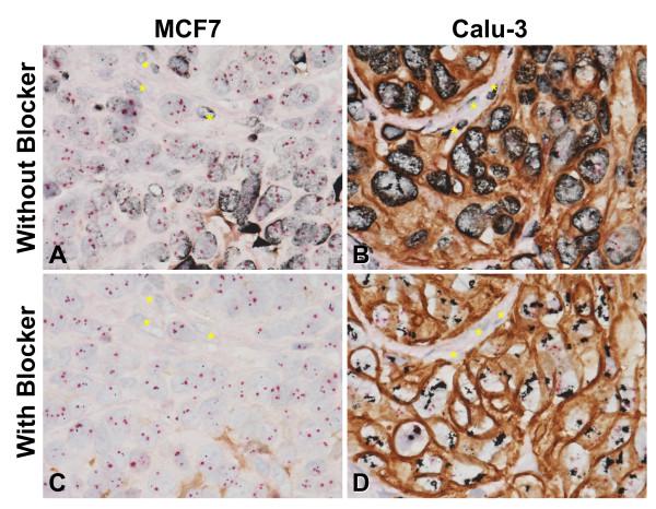 https://cdn.ncbi.nlm.nih.gov/pmc/blobs/8229/3487810/126e34151301/1746-1596-7-60-2.jpg