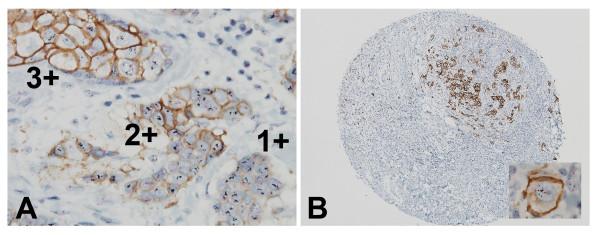 https://cdn.ncbi.nlm.nih.gov/pmc/blobs/8229/3487810/8772846c056c/1746-1596-7-60-5.jpg