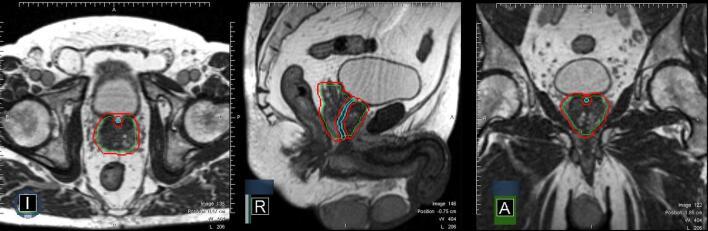 https://cdn.ncbi.nlm.nih.gov/pmc/blobs/822f/7807673/f1e4f281a926/gr1.jpg
