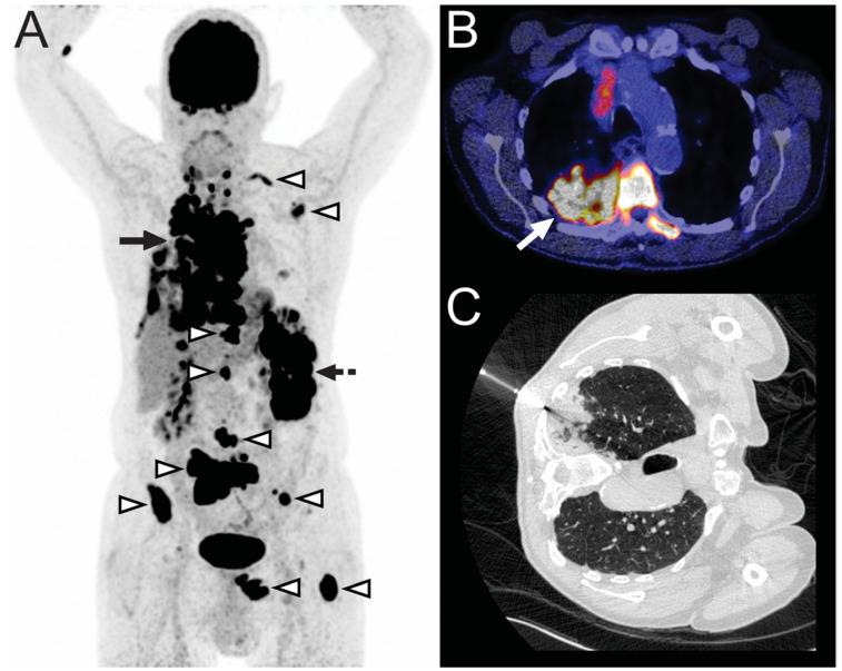 https://cdn.ncbi.nlm.nih.gov/pmc/blobs/8230/8003997/f14692776a8a/diagnostics-11-00559-g002.jpg
