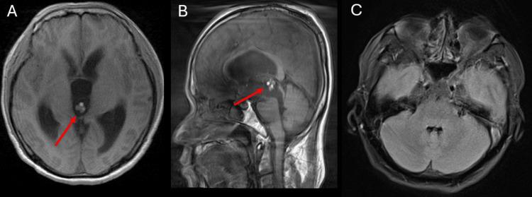 https://cdn.ncbi.nlm.nih.gov/pmc/blobs/8232/12136720/e561c117e07f/cureus-0017-00000083527-i01.jpg