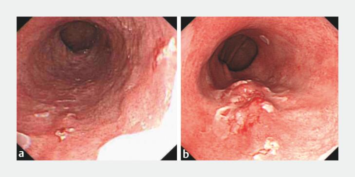 https://cdn.ncbi.nlm.nih.gov/pmc/blobs/8236/11864345/73c1d74cdef6/10-1055-a-2378-1464_23785710.jpg