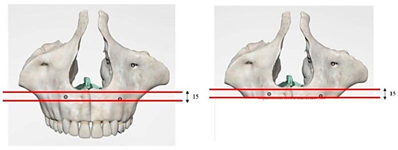 https://cdn.ncbi.nlm.nih.gov/pmc/blobs/823c/10452205/6b669a65f75d/biomimetics-08-00336-g002.jpg