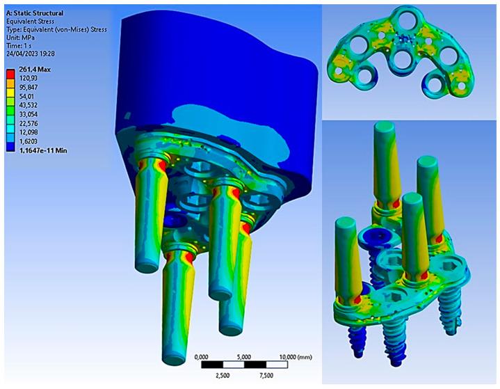 https://cdn.ncbi.nlm.nih.gov/pmc/blobs/823c/10452205/9d0ef9fac4a1/biomimetics-08-00336-g012.jpg