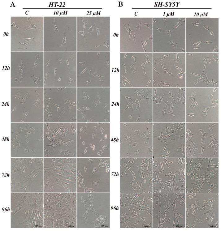 https://cdn.ncbi.nlm.nih.gov/pmc/blobs/823d/7700684/39e197b56a8e/ijms-21-08849-g003.jpg