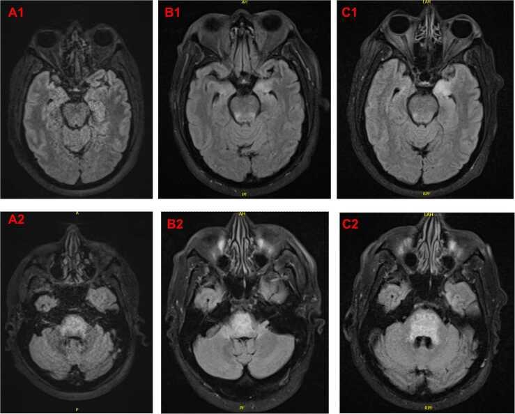 https://cdn.ncbi.nlm.nih.gov/pmc/blobs/8242/11263950/cc38b265cffd/gr1.jpg