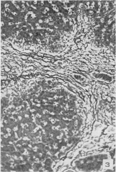https://cdn.ncbi.nlm.nih.gov/pmc/blobs/8244/1942870/03b65a8773f1/amjpathol00598-0093-c.jpg