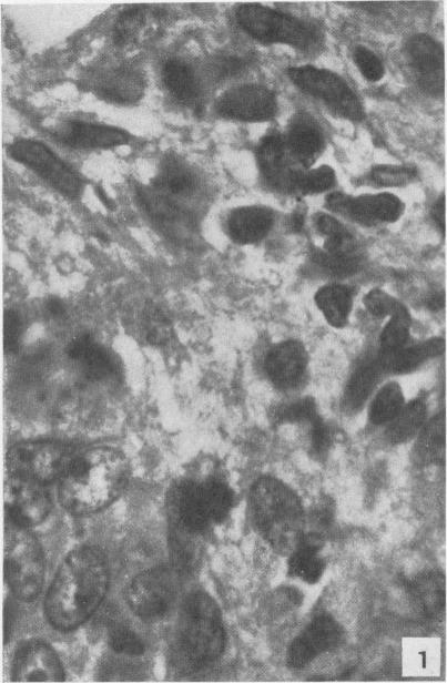 https://cdn.ncbi.nlm.nih.gov/pmc/blobs/8244/1942870/26e73ab4710d/amjpathol00598-0093-a.jpg