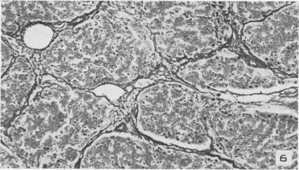 https://cdn.ncbi.nlm.nih.gov/pmc/blobs/8244/1942870/c6c27f5fa72d/amjpathol00598-0095-b.jpg