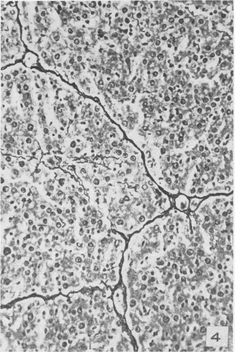 https://cdn.ncbi.nlm.nih.gov/pmc/blobs/8244/1942870/f6d010be3bcd/amjpathol00598-0093-d.jpg