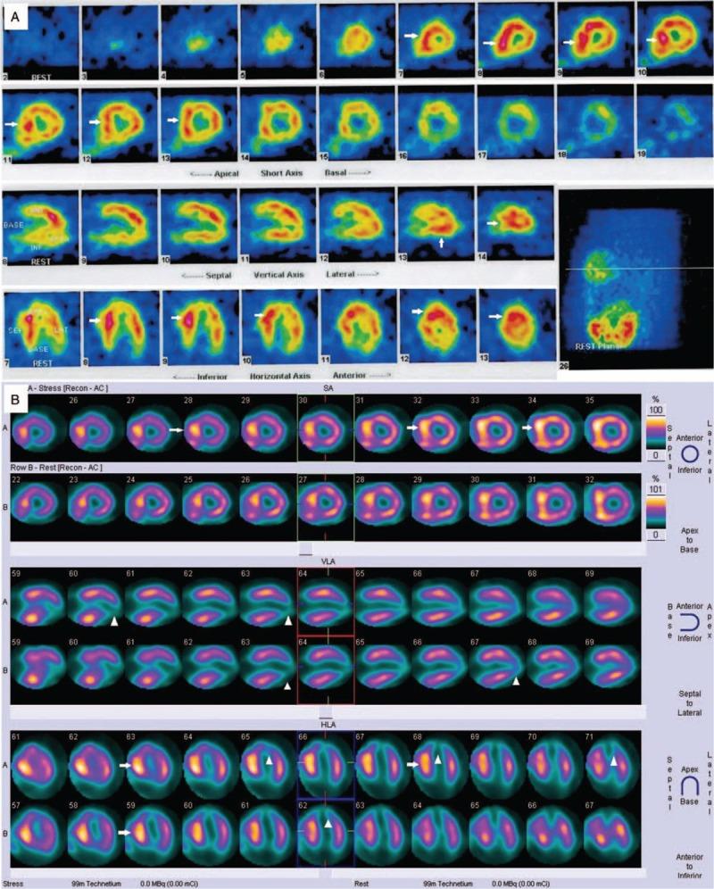 https://cdn.ncbi.nlm.nih.gov/pmc/blobs/8248/6392610/0247158793e8/medi-97-e10829-g004.jpg