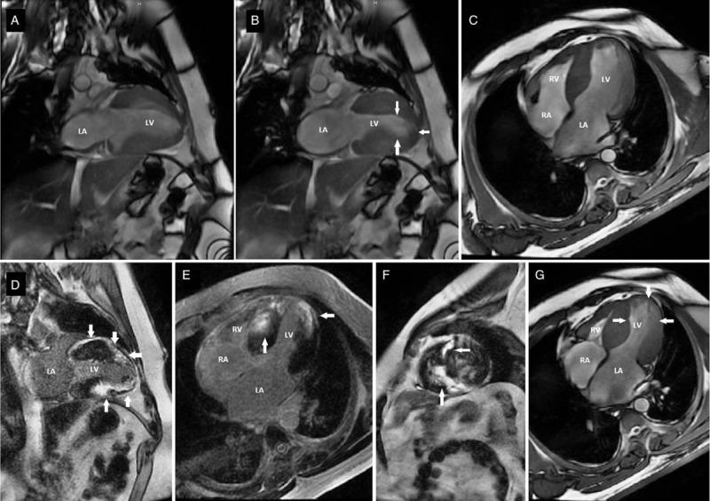 https://cdn.ncbi.nlm.nih.gov/pmc/blobs/8248/6392610/151f311bb515/medi-97-e10829-g003.jpg
