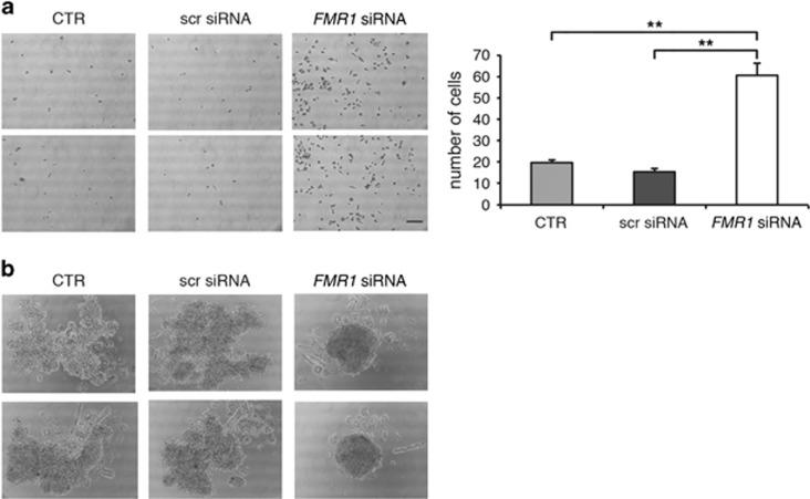 https://cdn.ncbi.nlm.nih.gov/pmc/blobs/8249/5775405/d377e3a667a5/cddis2017521f5.jpg