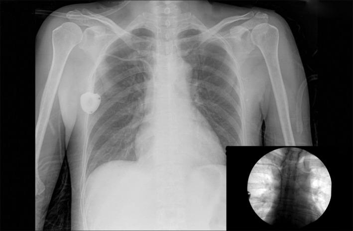 https://cdn.ncbi.nlm.nih.gov/pmc/blobs/824a/5494449/2bc53caa1c15/TCA-8-363-g001.jpg