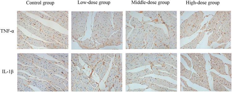 https://cdn.ncbi.nlm.nih.gov/pmc/blobs/824b/8901264/9f0e4c01071f/JIR-15-1599-g0011.jpg