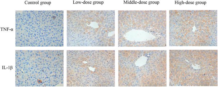 https://cdn.ncbi.nlm.nih.gov/pmc/blobs/824b/8901264/fc047fbef272/JIR-15-1599-g0010.jpg